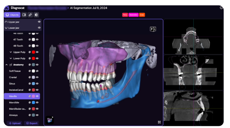 Diagnocat — analiza CBCT